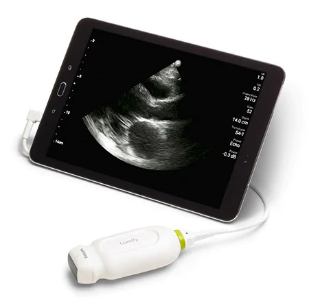 Medoc Egészségközpont - Philips Lumify L12-4 mobil ultrahang